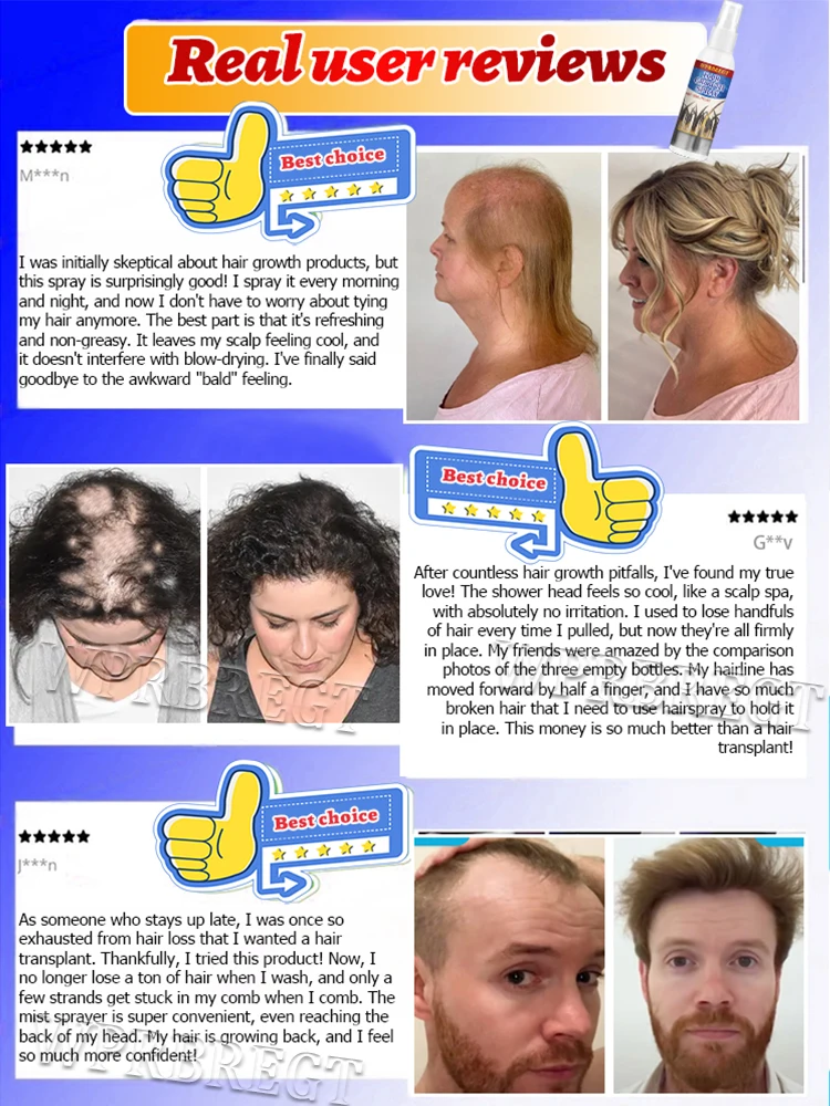 تركيبة مغذية جديدة للجذور لزيادة حجم الشعر 10 سم