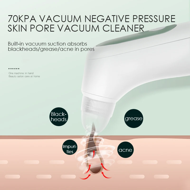KSKIN Beauty Equipment Detergente per pori dell'acne per il viso Aspirapolvere visibile per la rimozione dei punti neri