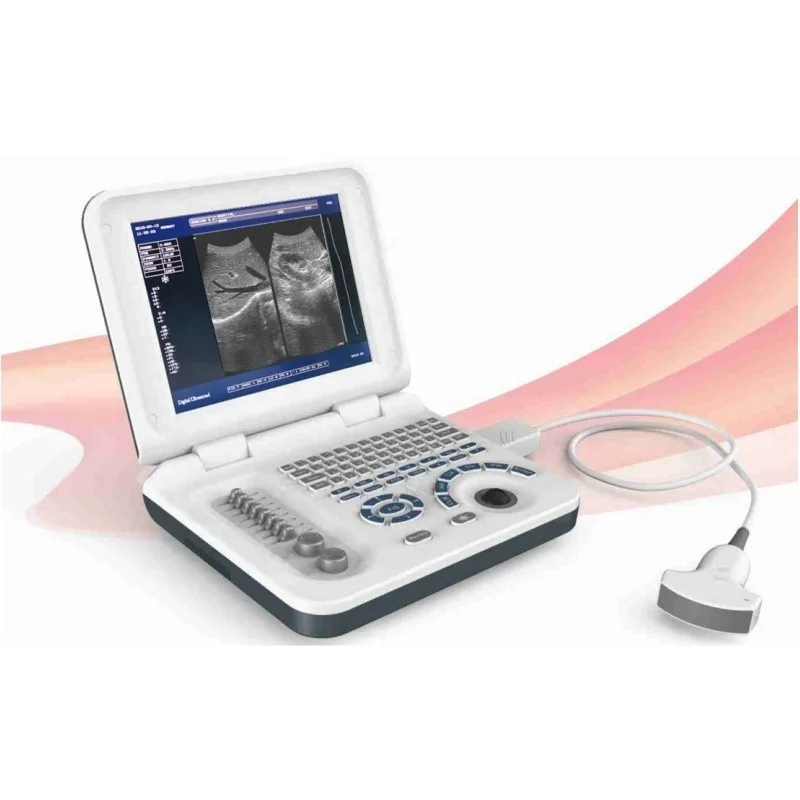 Portable Vet Ultrasound Scanner Ultrasound Machine for Veterinary Use Animal Care and Supplies