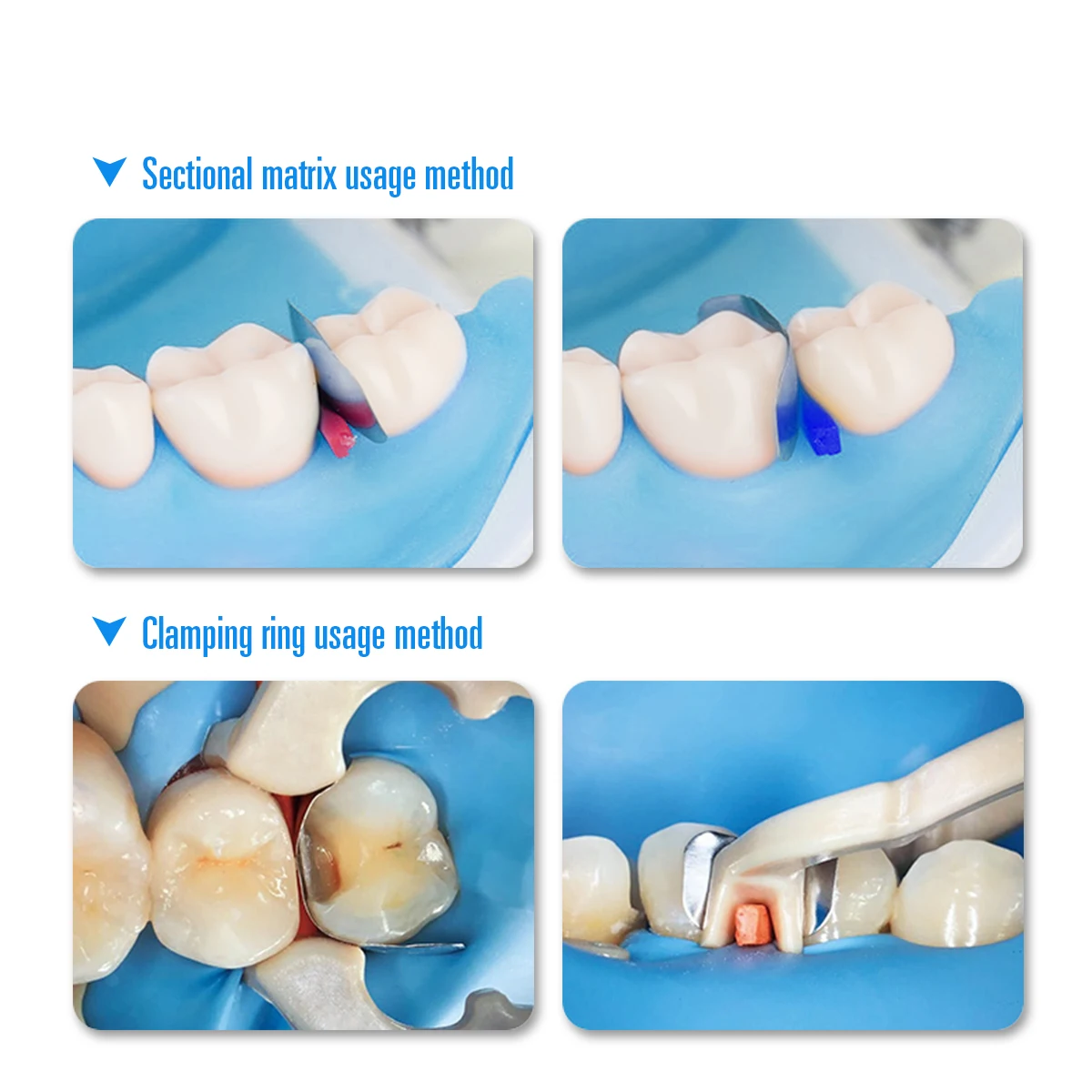 AZDENT Dental przekrój wyprofilowane matryce metalowe wkład matrycy 30 sztuk przekrojowe opaski matrycowe żywica pierścień mocujący pierścień