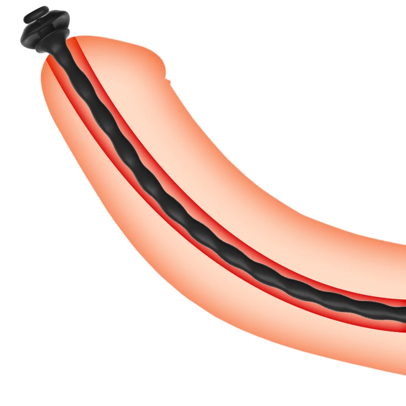 رخيصة مضاد للجراثيم قسطرة الإحليل السبر الحصان العين قضيب لعبة استثارة القضيب الاستمناء الإدراج البولية موسع الجنس لعب للرجال