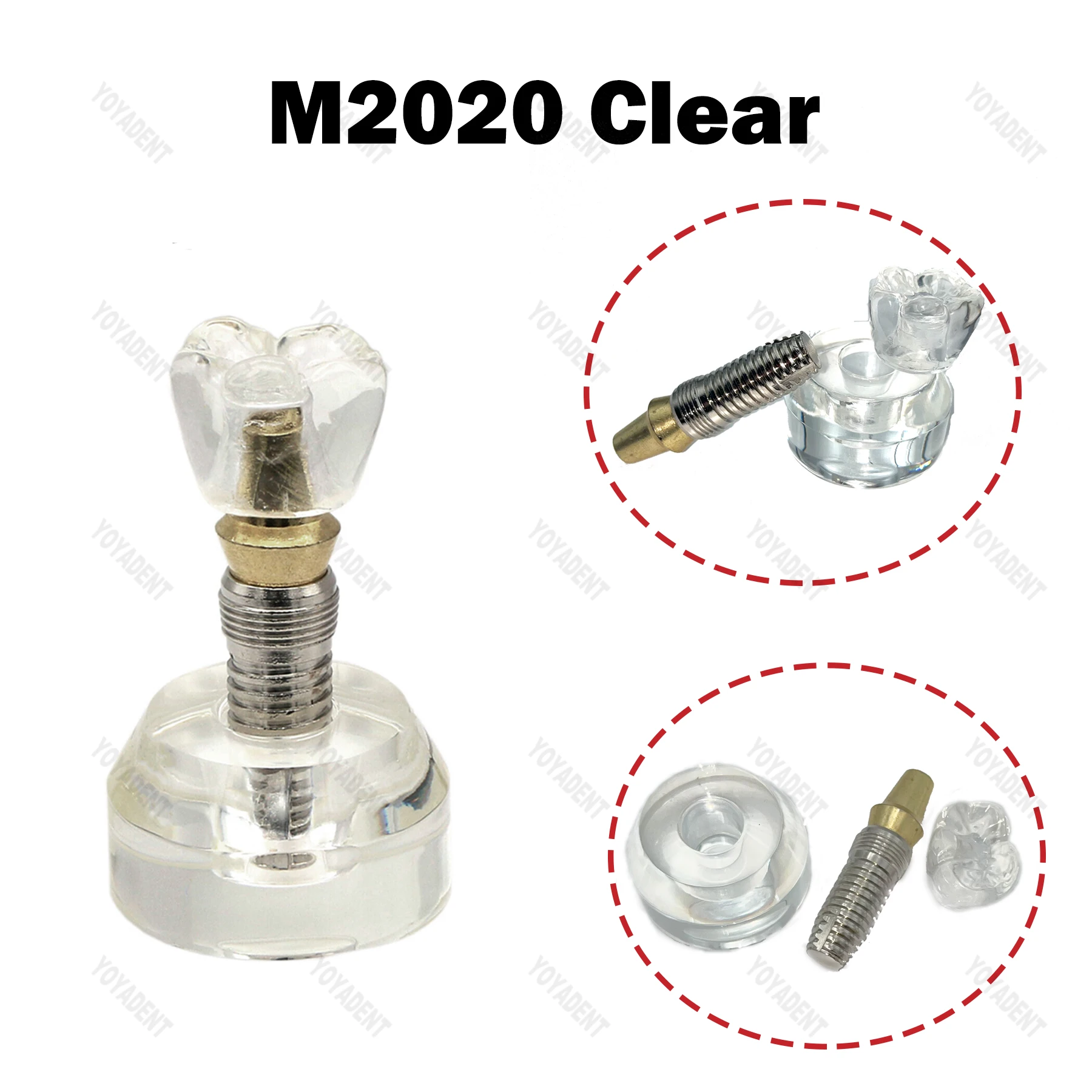 Стоматологическая модель 2,5x размера, модель имплантации зубов, обучающие модели зубов для стоматолога, связь пациента, демонстрационные аксессуары для стоматологии