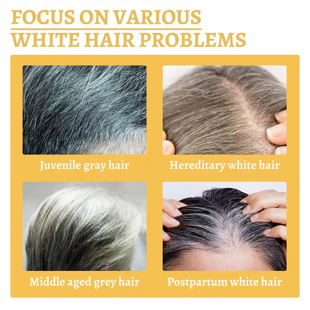 10PCS Gray White Hair Treatment Serum Liquid White To Black Natural Color Repair Nourish Products Anti Loss Hair for Men Wome