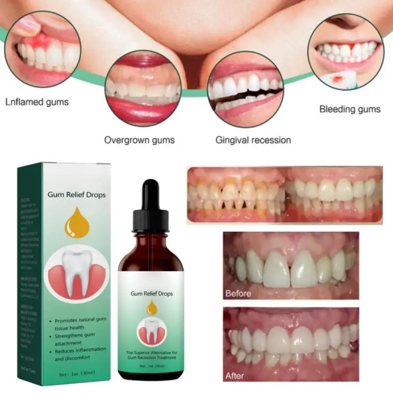 30ml Gum Care Products Liquid Gum Repair Gum Regrowth Natural Oral Care Drops Gum Restore Oral Gum Care Liquid For Oral Car