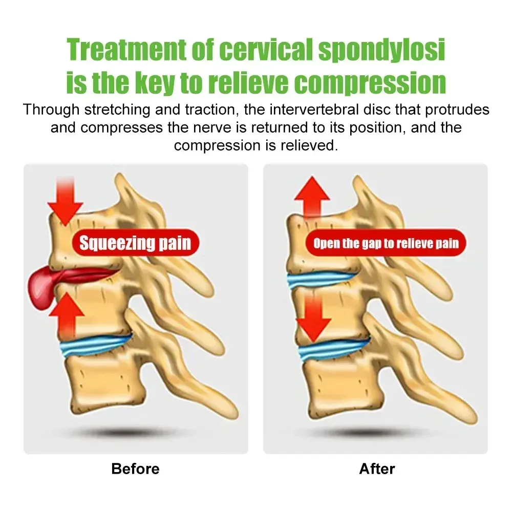 Dispositivo di trazione cervicale regolabile Barella per collo sospesa con cuscino per alleviare il dolore e supporto chiropratico per l'allineamento della colonna vertebrale