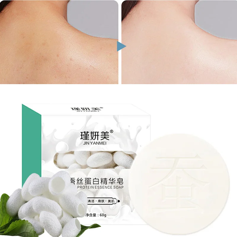 Body Whitening Soap Underarm Knee Bleaching Soap Acne Treatment Cleaning Blackhead Mites Removal Dead Skin Whiten Face Body Care