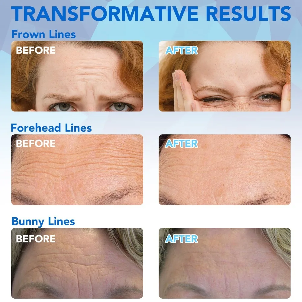 16 قطعة متعددة الأغراض المضادة للتجاعيد شرائط الوجه ترطيب الشريط خطوط الجبين مزيل قابلة لإعادة الاستخدام مكافحة الشيخوخة ملصقات الوجه