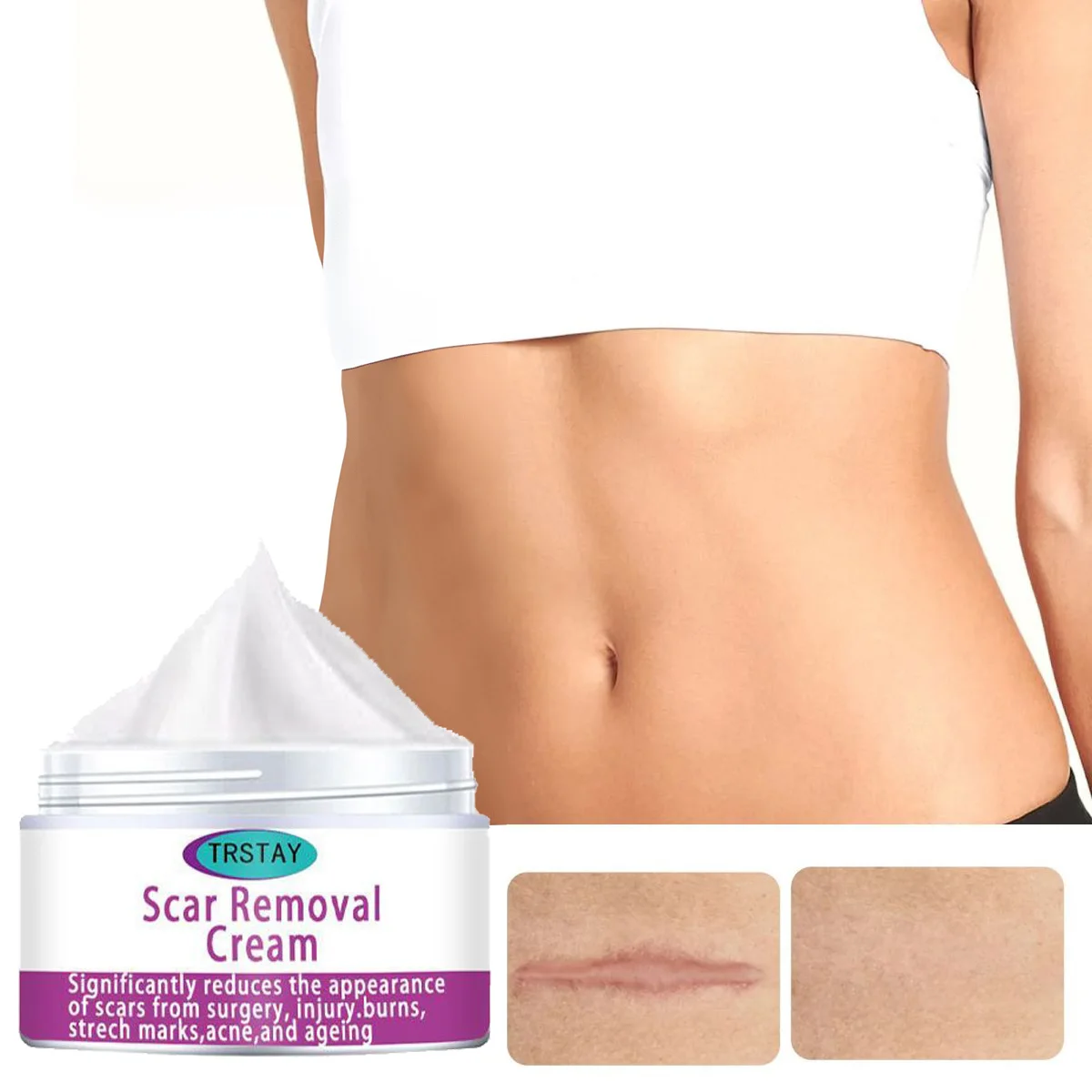 Repairing Scar Blackhead Shrink Pores  crema para manchas de la cara  crema aclaradora de piel