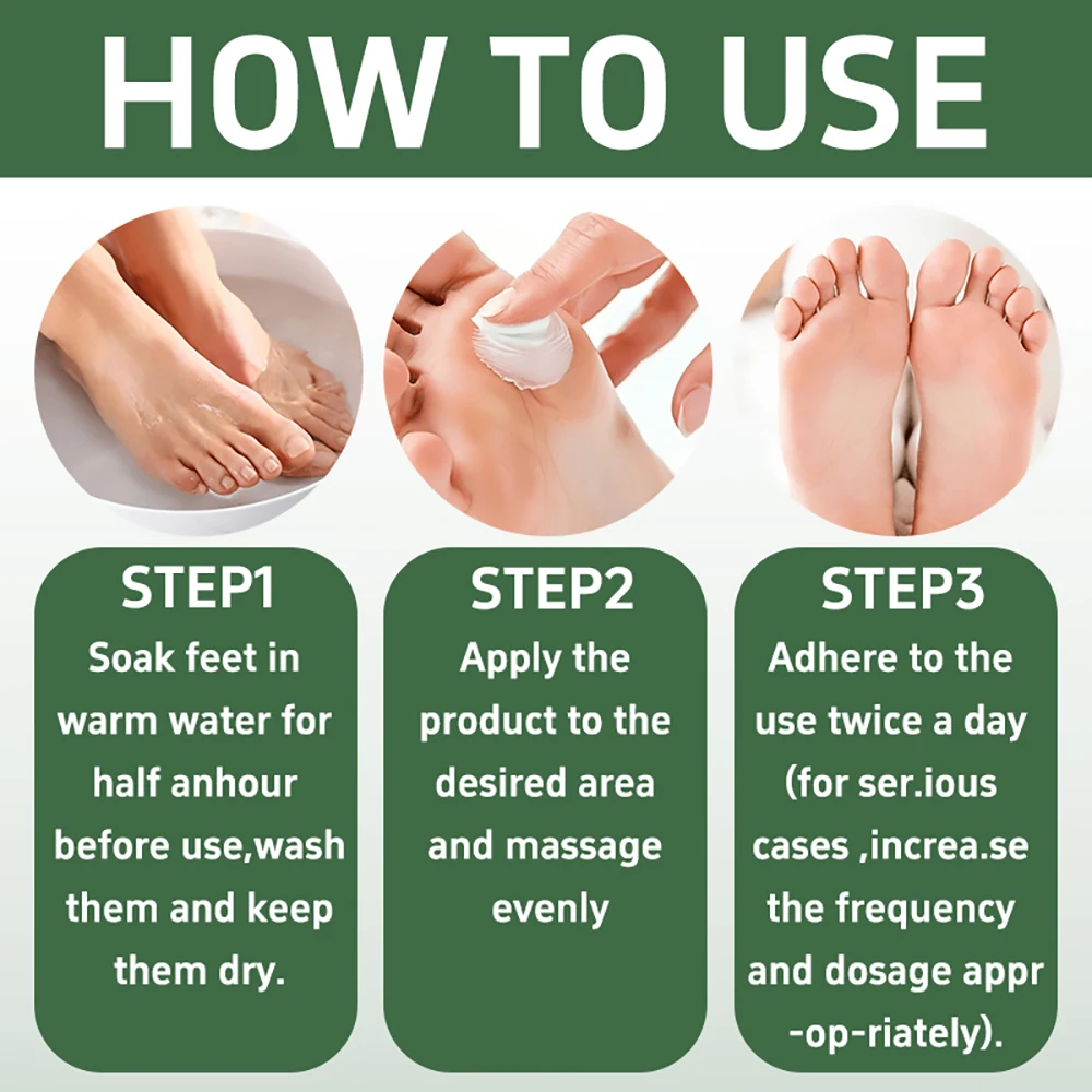 SUYARUN 60% Urea Foot Care Cream, suit for cracked heels and dry skin - deep moisturizing treatment, exfoliation, no blind spots view 6