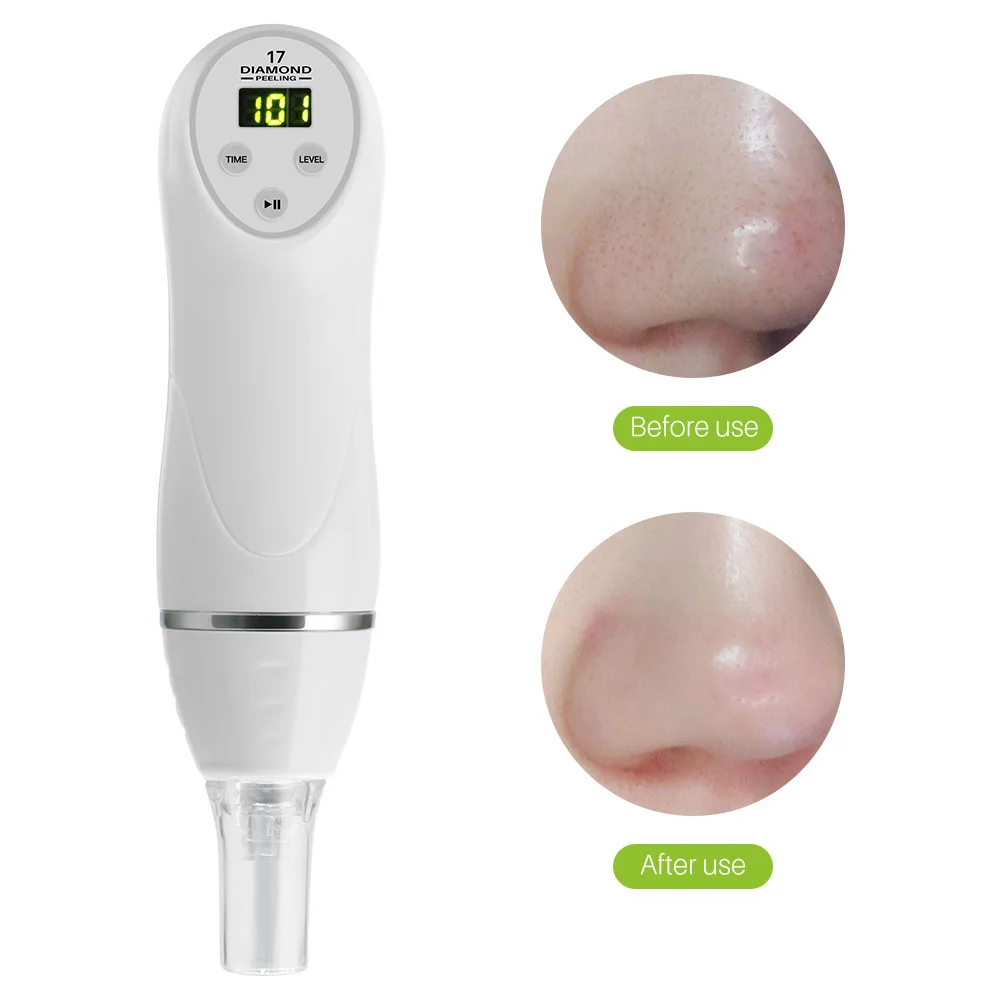 Micro Acne Remover Tool Vacuum Ultrasonic Pore Cleanser Blackhead Removal Diamond Tip Facial Massager for Home Skincare Device