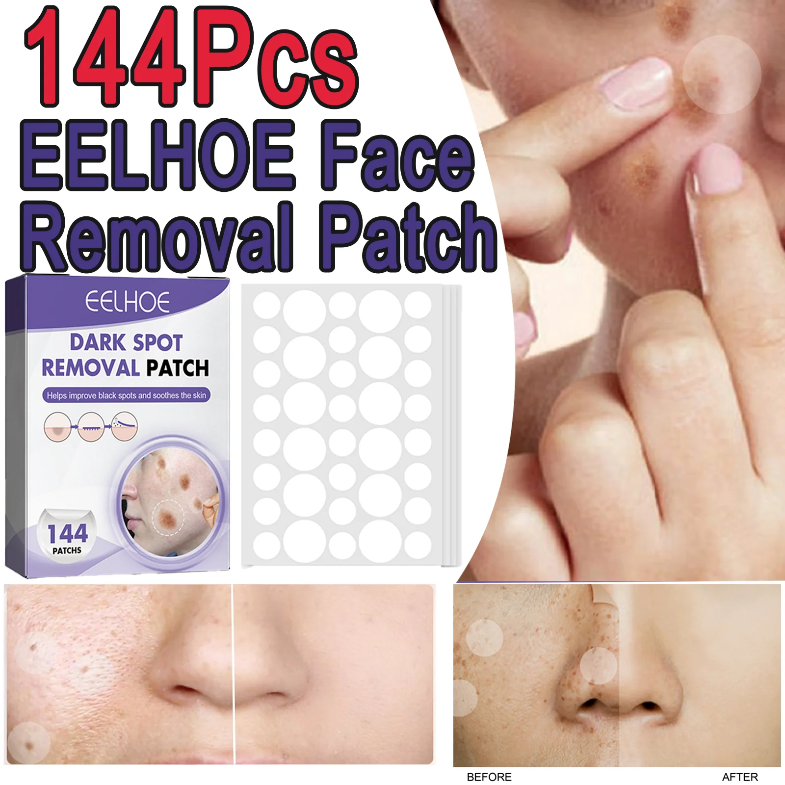 144Pcs EELHOE Hydrocolloid Face Removal Patch Niacinamide Vitamin C Smooth Skins Improve Cleansing Brightening Skin Shrink