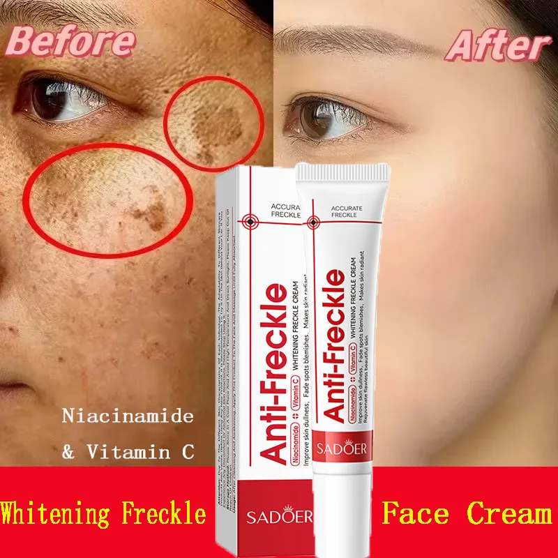 

Powerful Whitening Freckles Face Cream Dark Spot Corrector Removal Melasma Fade Melanin Pigmentation Brighten Skin Care Products