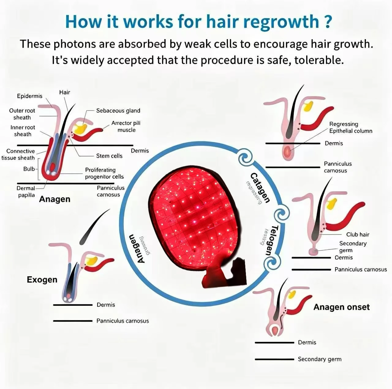 

212PCS LLLT Laser Hair Growth Cap 650nm Low Level Laser Therapy Cap for Hair Regrowth, Treat Thinning Hair and Baldness