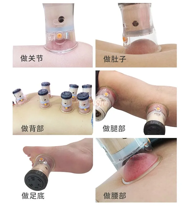 3pcs Cupping moxibustion hall moxibustion tool for whole body universal special Bianstone moxibustion pot all-in-one small