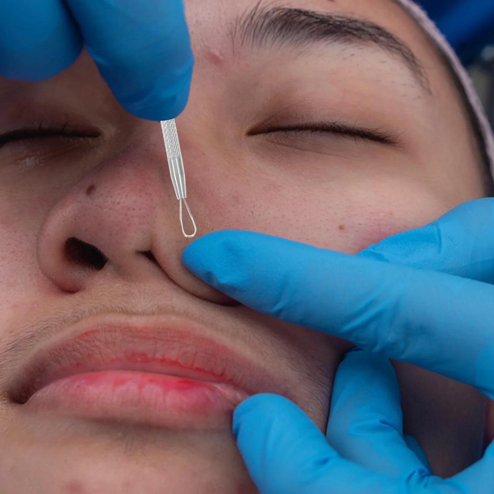 7 pçs removedores de cravo premium ferramentas de espinha de aço inoxidável para cuidados com a pele extração de cravos comedone de duas cabeças