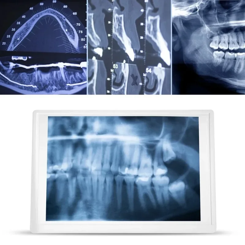 

A4 Dental Film Viewer X-ray Dental Laboratory Tool Box Dentist Oral Hygiene Panoramic View Box of X-ray Panel Screen