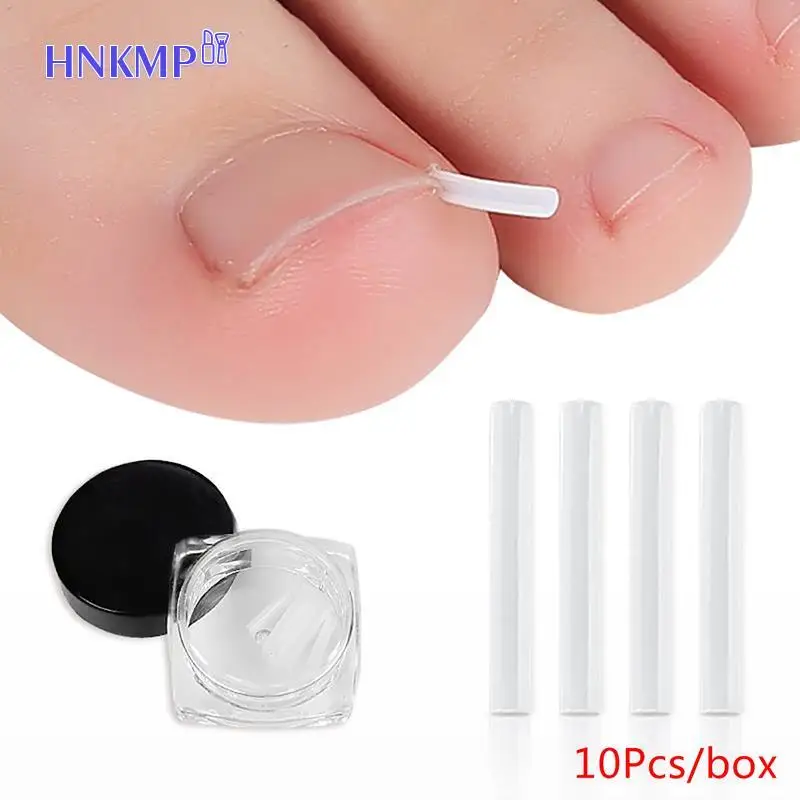 10 Stks/pak Teennagel Rechttrekken Clip Ingegroeide Teennagel Correctie Tool Nail Behandeling Elastische Patch Sticker Voetverzorging Pedicure