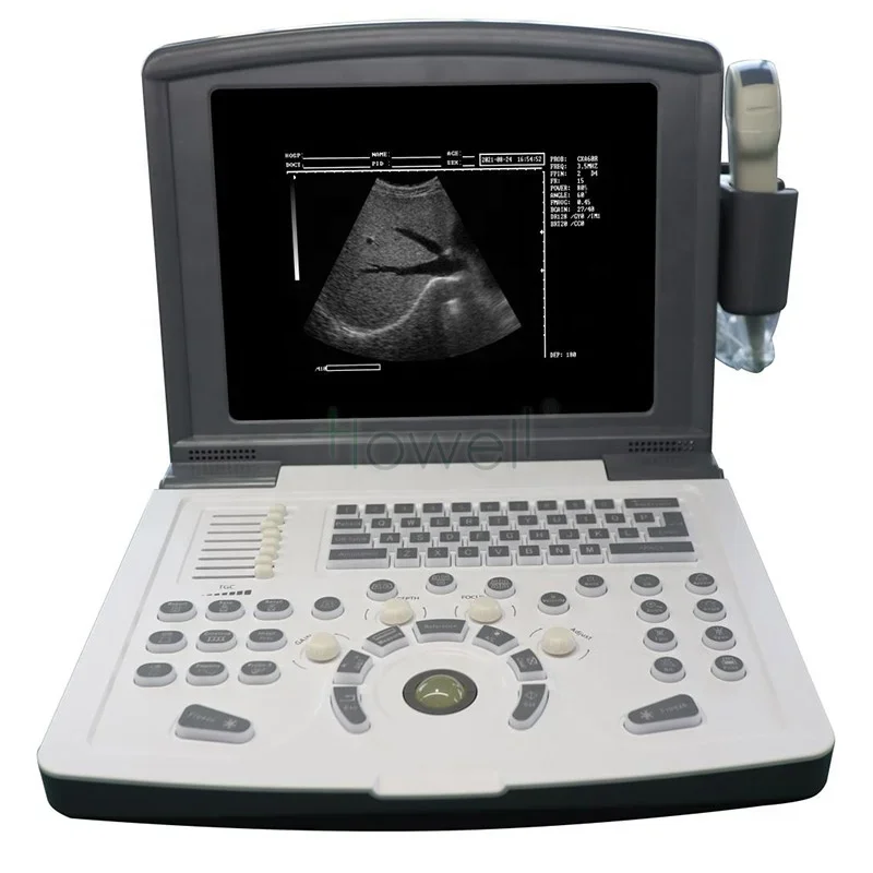 

B/W Mode Hospital and Clinic Use Full Digital Portable Ultrasound Device Machine with Convex Linear Probe