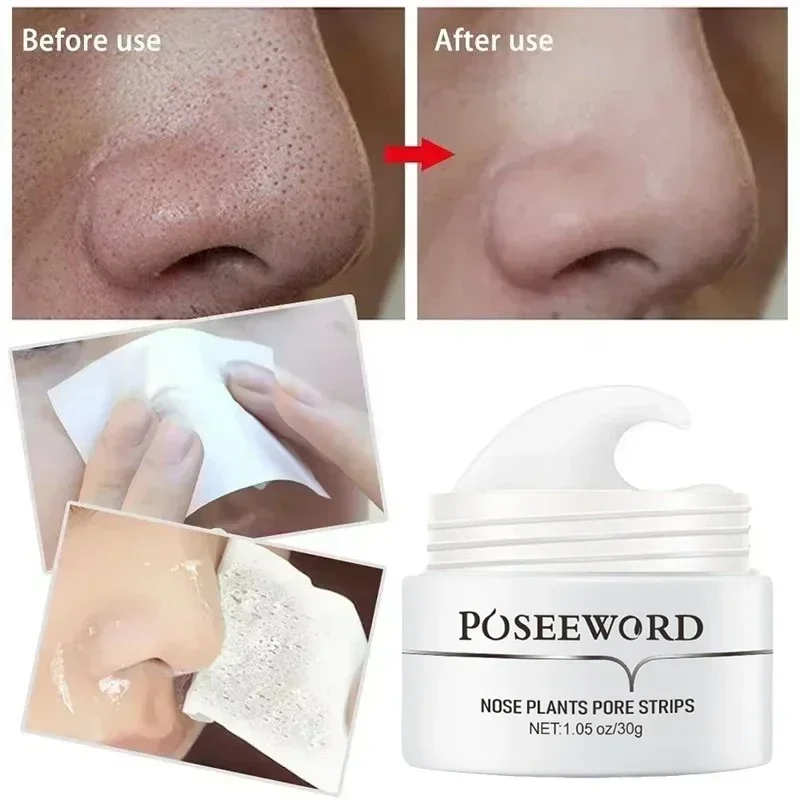 Efficient Blackhead Remover Nose Mask Pore Strip Black Mask Peeling Acne Treatment Black Deep Cleansing Skin Care Korea image 6
