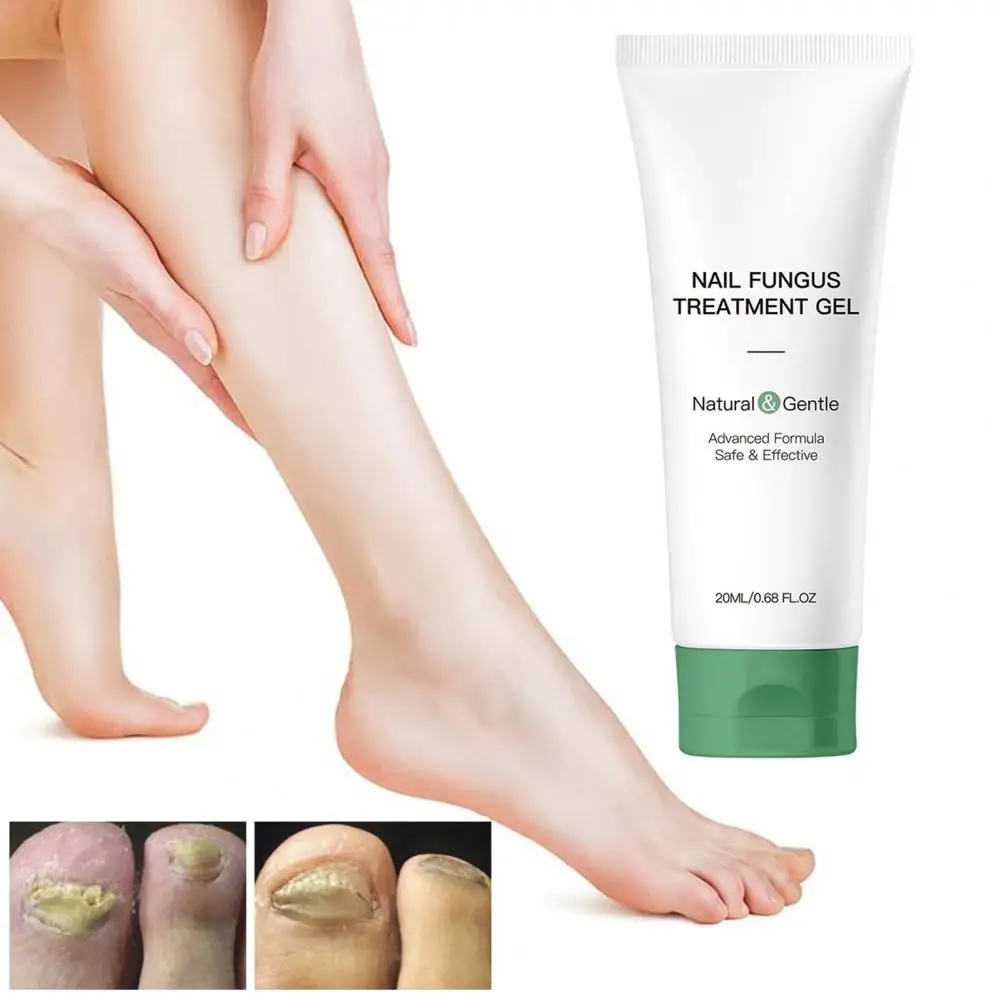 Nail Repair Gel Natural Nail Fungus Treatment Gel for Men Women Hydrating Moisturizing Repair Care Portable Multi-purpose
