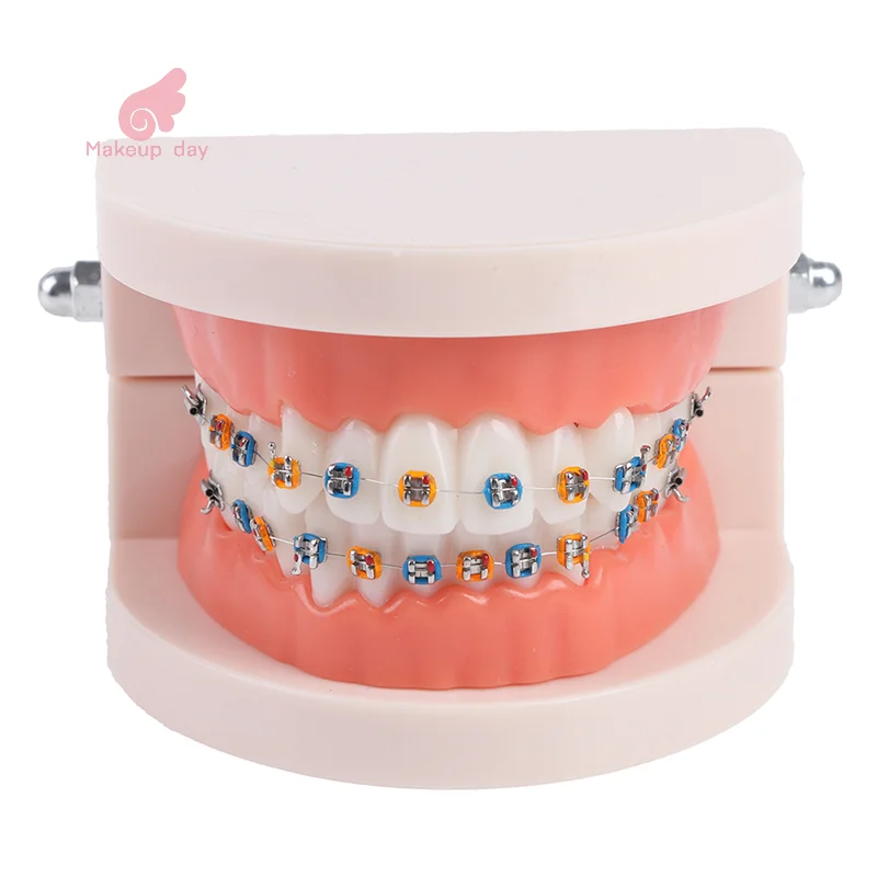 

Dental Orthodontic Teeth Model With Metal Braces School Teaching Equipment