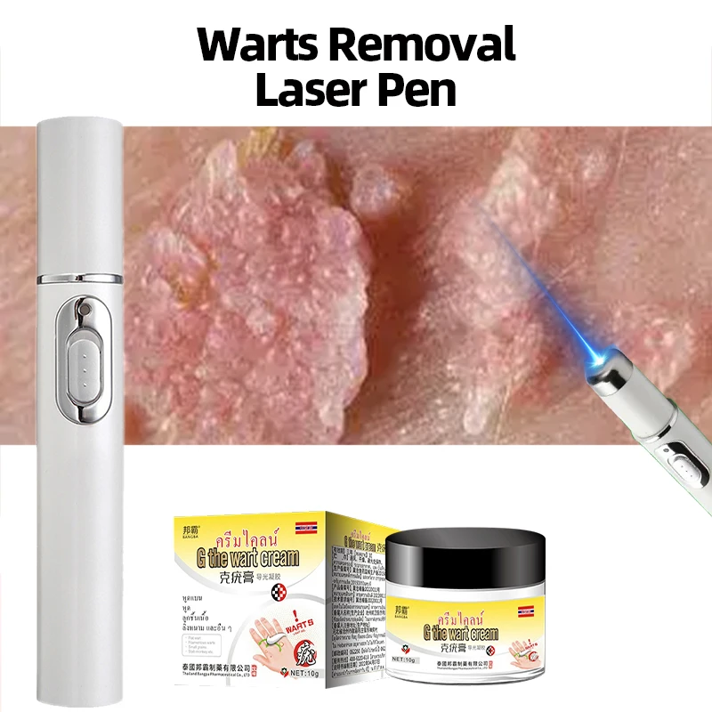 

Wart Remover Laser Pen for Men and Women Precision Care for Plantar Genital Common Corn Warts