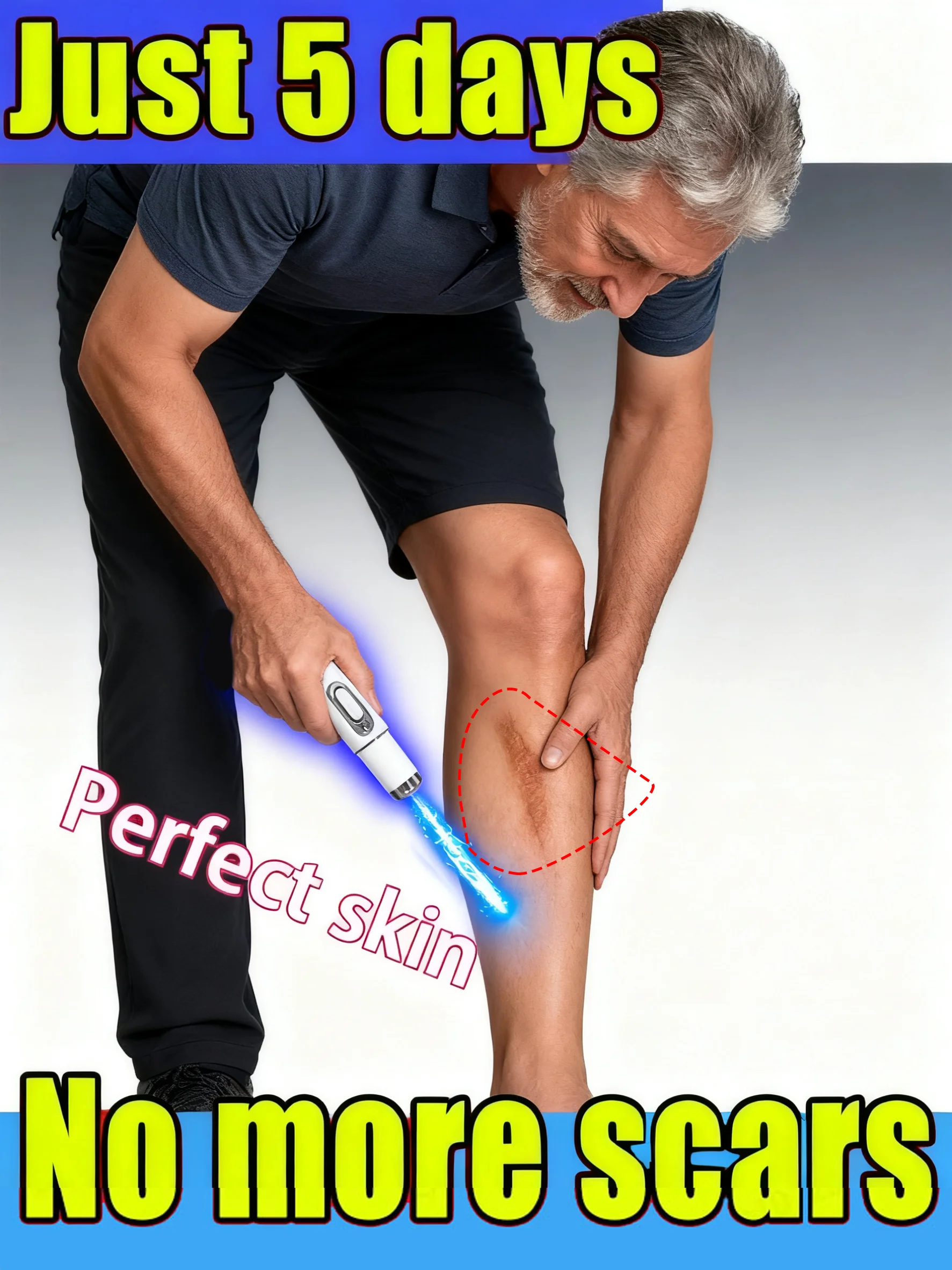 

2025 hot sale Blue light Laser pen solve scar,body skin beauty scar care tools unisex