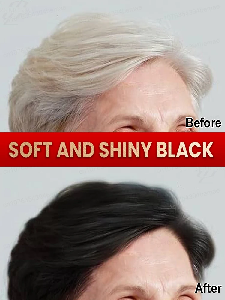 

Feed your hair, white fades, black grows full