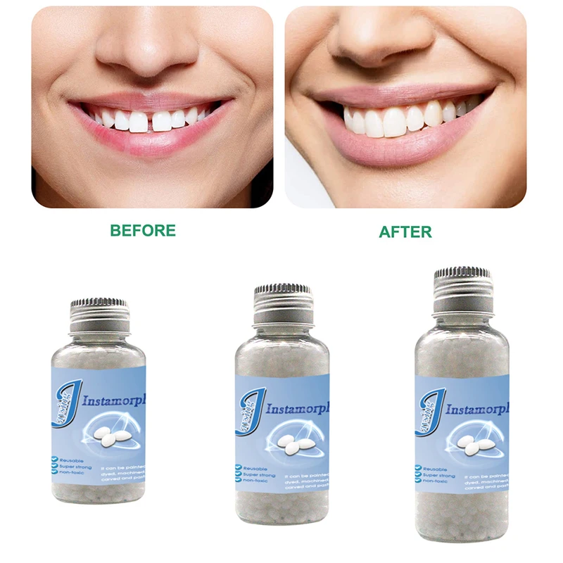 

3/10/20/30ml Resin False Teeth Solid Glue Temporary Tooth Repair Denture Adhesive Teeth Makeup Denture Modification Filling Glue