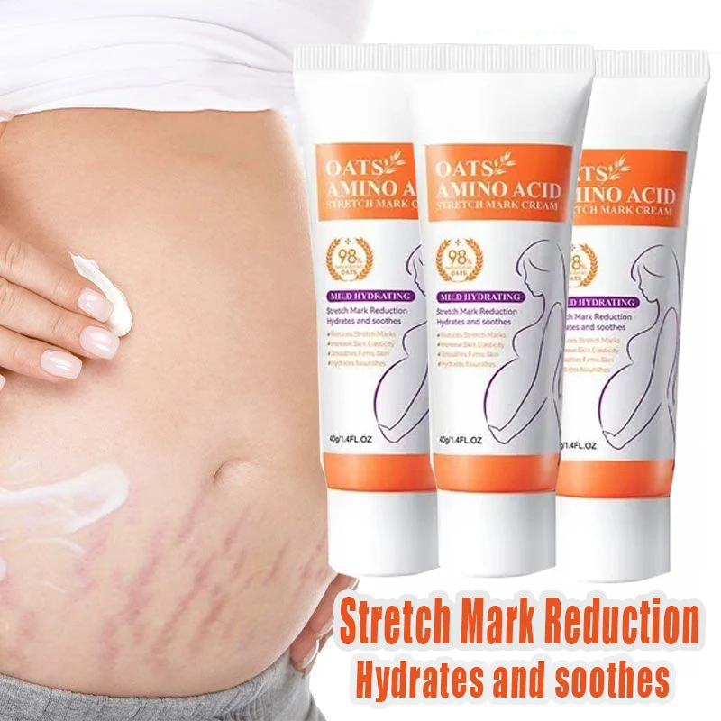 

Stretch Marks Moisturize Cream Eliminate Body Belly Stretch Marks Removal Swelling Marks Remove Skin Cracks Repair Firming Care