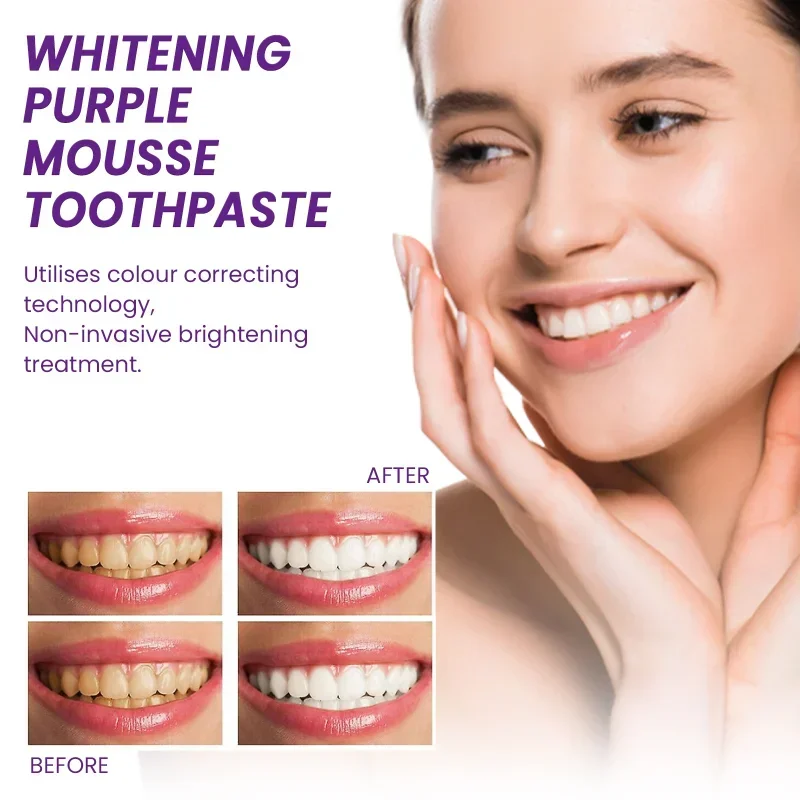 

Sdotter New Whitening Purple Mousse Toothpaste Cleaning Yellow Tooth Tartar Remove Cigarette Stains Teeth Anti-Cavity Oral Care