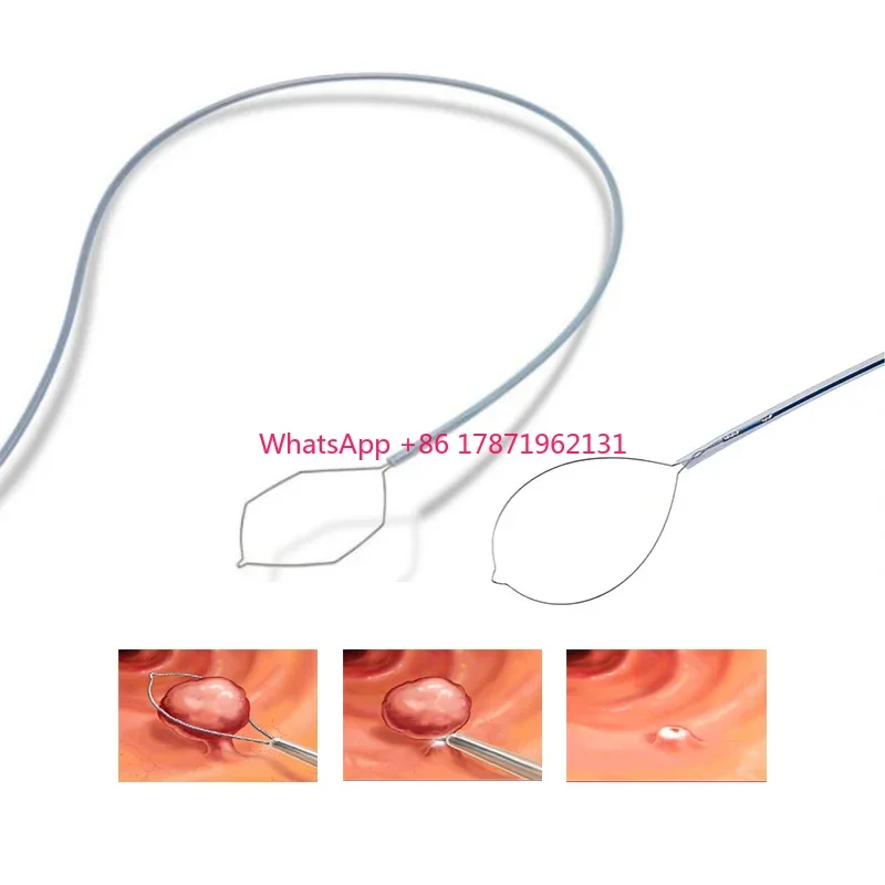 High Quality Disposable Medical Polypectomy Snare Rotatable Polypectomy Snare