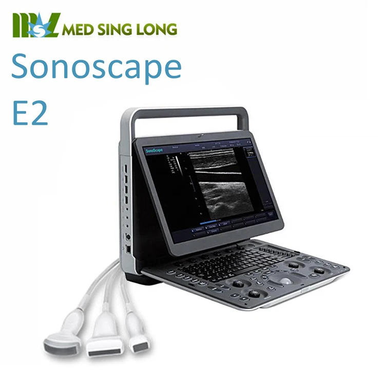 Medical Portable Sonoscape E2 3D 4d Digital Color Doppler OB/GYN Ultrasound machine