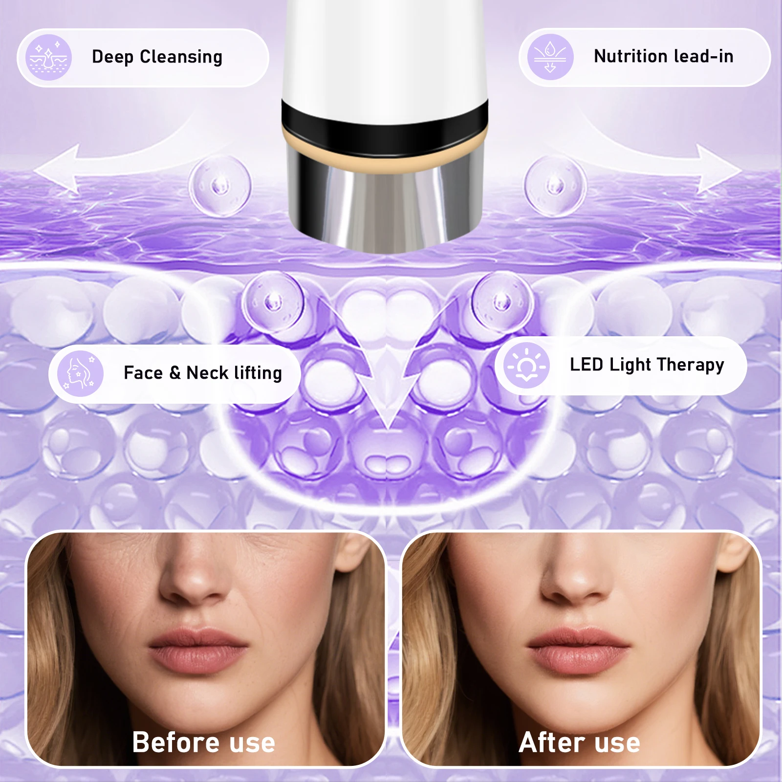 The Electric Facial Massager Can Vibrate and Lift The Facial Skin in 4 Adjustable Modes Women Beauty Instrument Skin Care Tool view 2