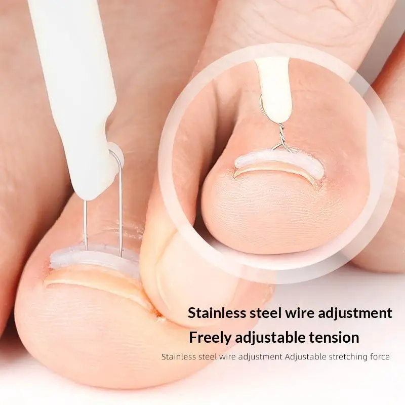 Ingrown Toenail Corrector Tool Set Easy to Use Painless Professional Pedicure Kit for Foot Nail Treatment