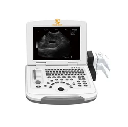 EURPET Cheap Medical Table Top Ultrasound Scanner System Ultrasound Machine With Probes Price