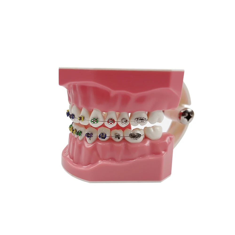 Orthodontic Dental Model With Bracket Braces Typodont 1:1 Teeth Model Orthodontic Treatment Model Typondont Jaw Model