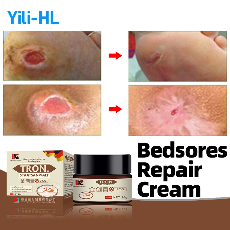 

Germany Bedsores Wound Healing Treatment Cream Anti Bed Sore Decubitus Pressure Ulcer Medicine Remove Rot Myogenic Skin Ointment