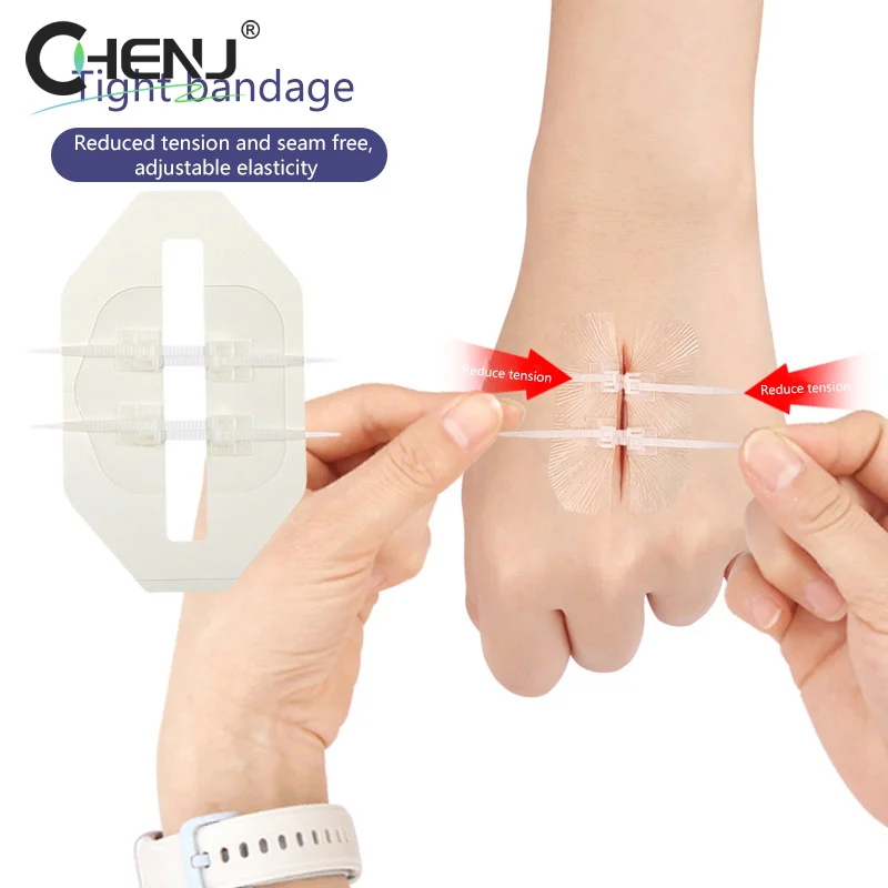 Zipper Tie Wound Closure Patch Zipper Band-Aid Wound Fast Suture Outdoor Portable Hemostatic Patch First Aid Tool