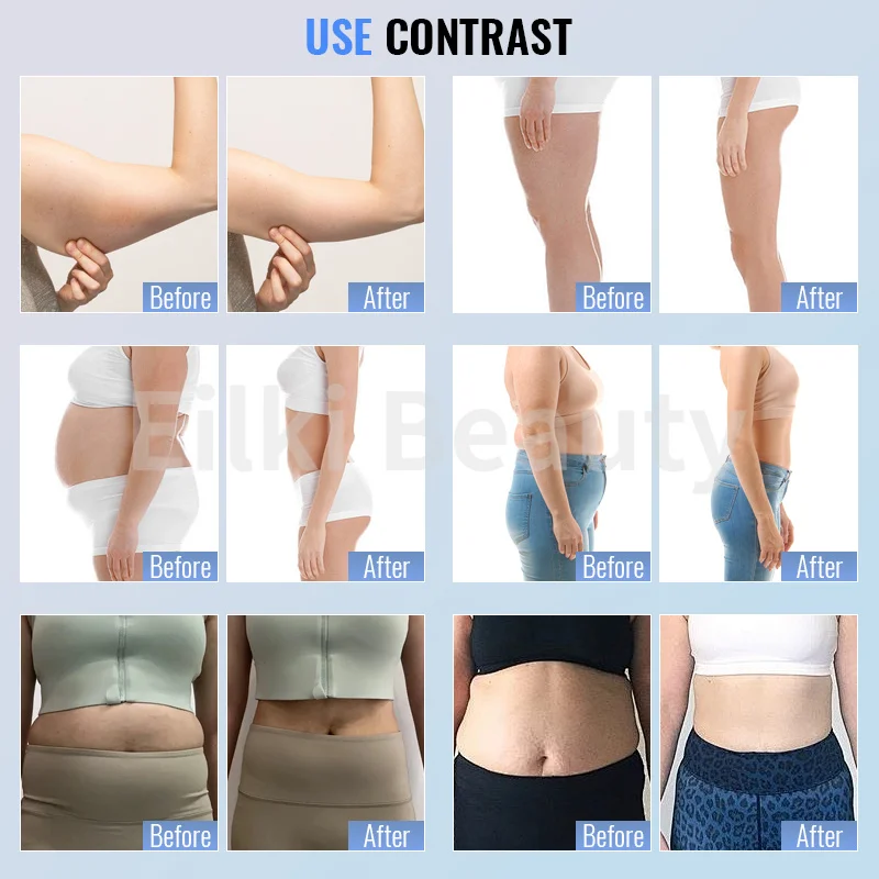 Newest 3 In 1 Cellulite Reduction 360 Degree Vibrating Massage Inner Roller Body Slimming Cellulite Reduce Butt Lifting Machine