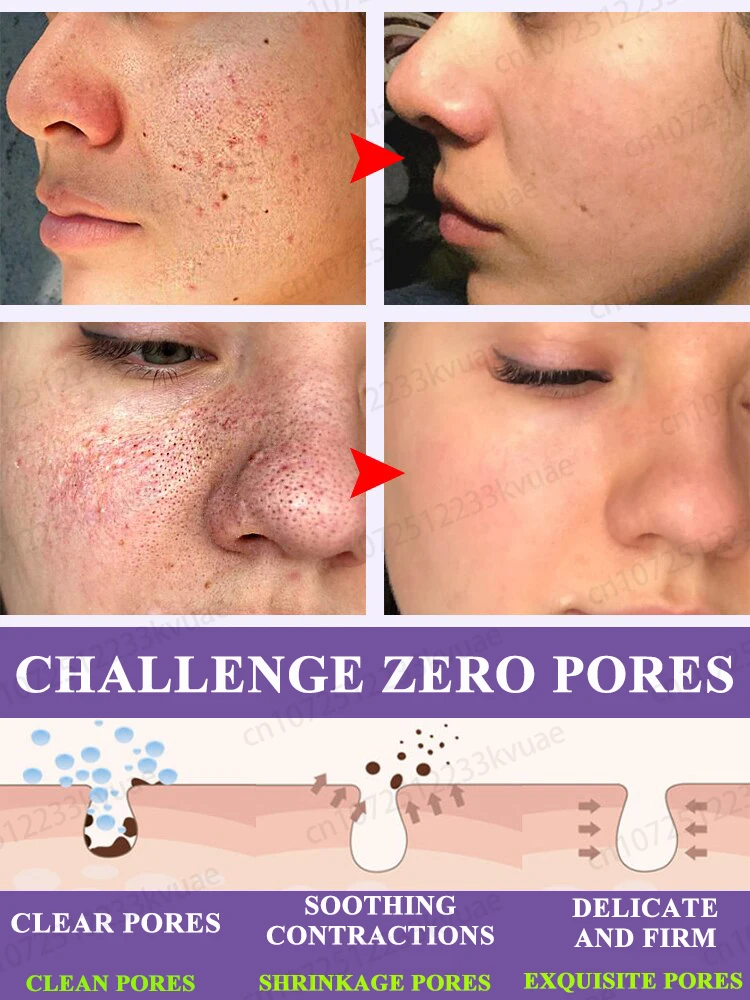 Pore repair essence, repair rough and dull pores, restore perfect skin