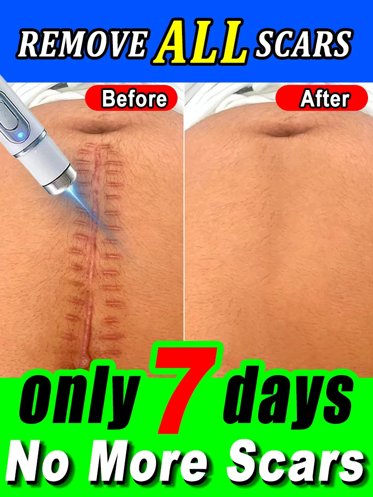 No scars, smooth skin