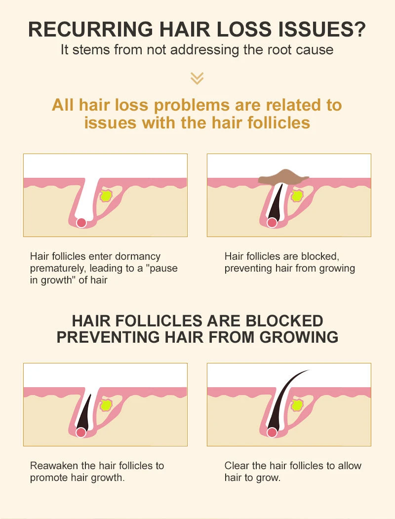 جوهر نمو سريع لنمو الشعر ، ومنع تساقط الشعر ، وتعزيز فروة الرأس المغذية السميكة ، وتجديد الرعاية ، وتنشيط بصيلات الشعر