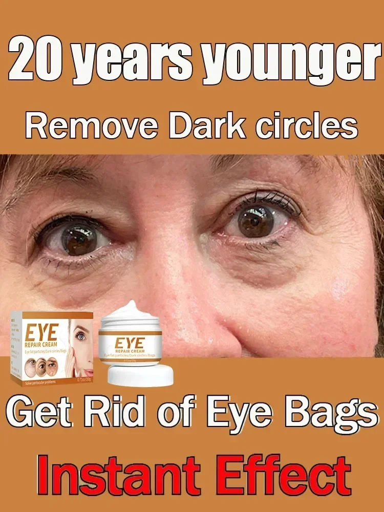 Dark Circles Eye cream Remove eye bags Puffiness Anti-Wrinkle way work under eyes Lightening Moisturizing Whitening Skin Care