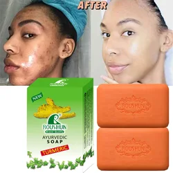 2Pcs Turmeric Soap Face Cleansing Anti Acne Whitening Skin Lightening Face Remove Pimples Dark Spots Lightening Handmade Soap