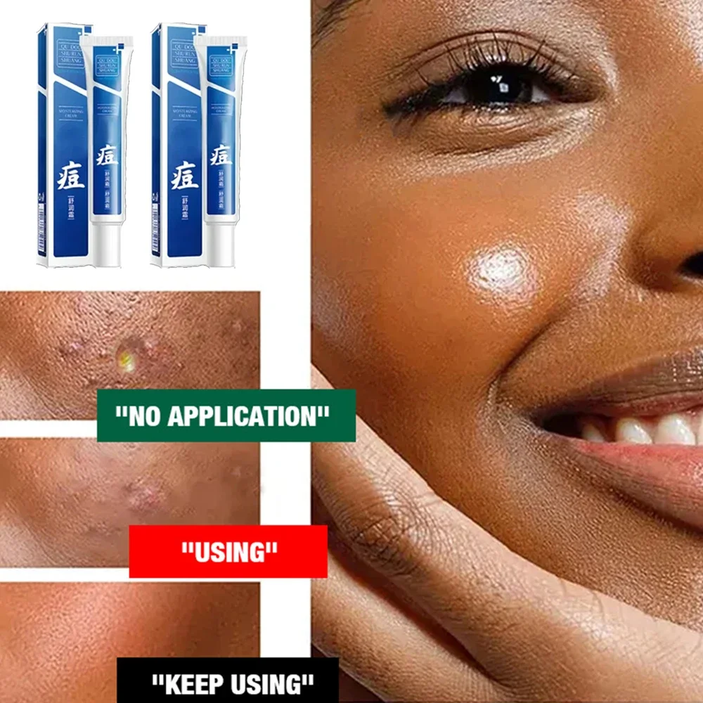 

Acne Remover Cream for Tightening Pores, Moisturizing Face Cream with Oil Balancing Formula Clear Skin Care