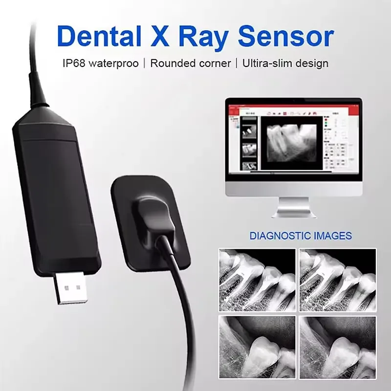 High-Definition RVG Sensor for Handy Sensor Oral Portable Digital X-Ray Sensor