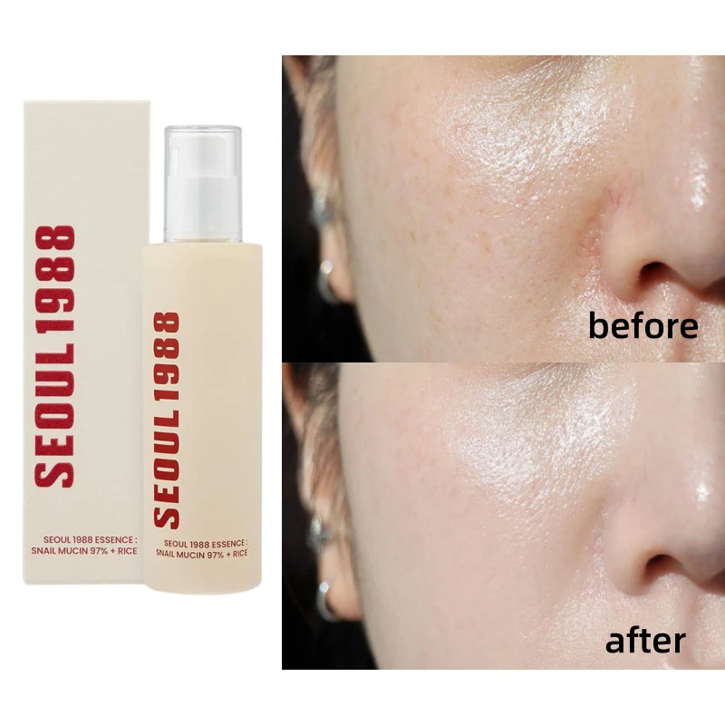 سيول 1988 مجموعة العناية بالبشرة الكورية الحلزون Mucin العناية بمحيط العين فيتامين C الريتينول إزالة الهالات السوداء سيول 1988 مستحضرات التجميل الكورية