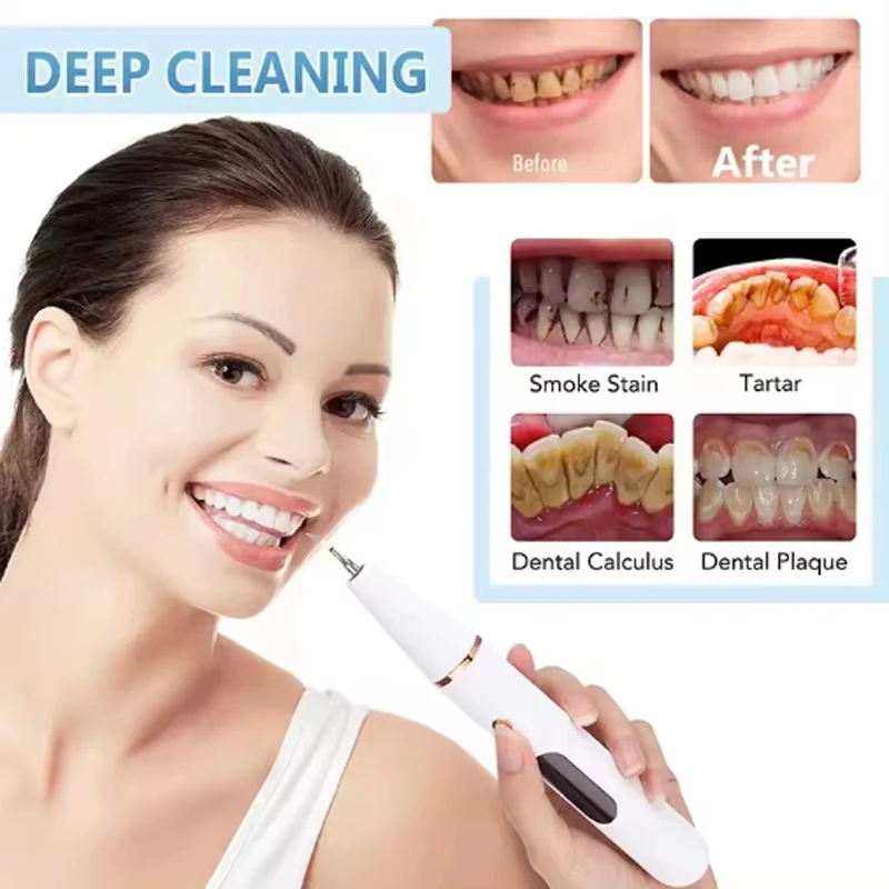 Household Electric Dental Calculus Remover Portable Dental Scaler Whitening Teeth Pen Ultrasonic Tooth Cleaner Whitening Tee