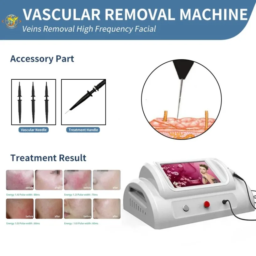 Beauty Equipment 10 W E Vascular R-F Spider Vein Removal Vascular Therapy Varicose Vei Ode Treat